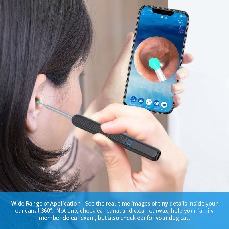 NE3 Wireless Otoscope Ear Cleaner with Camera & LED Light – Ear Wax Removal Tool for iPhone